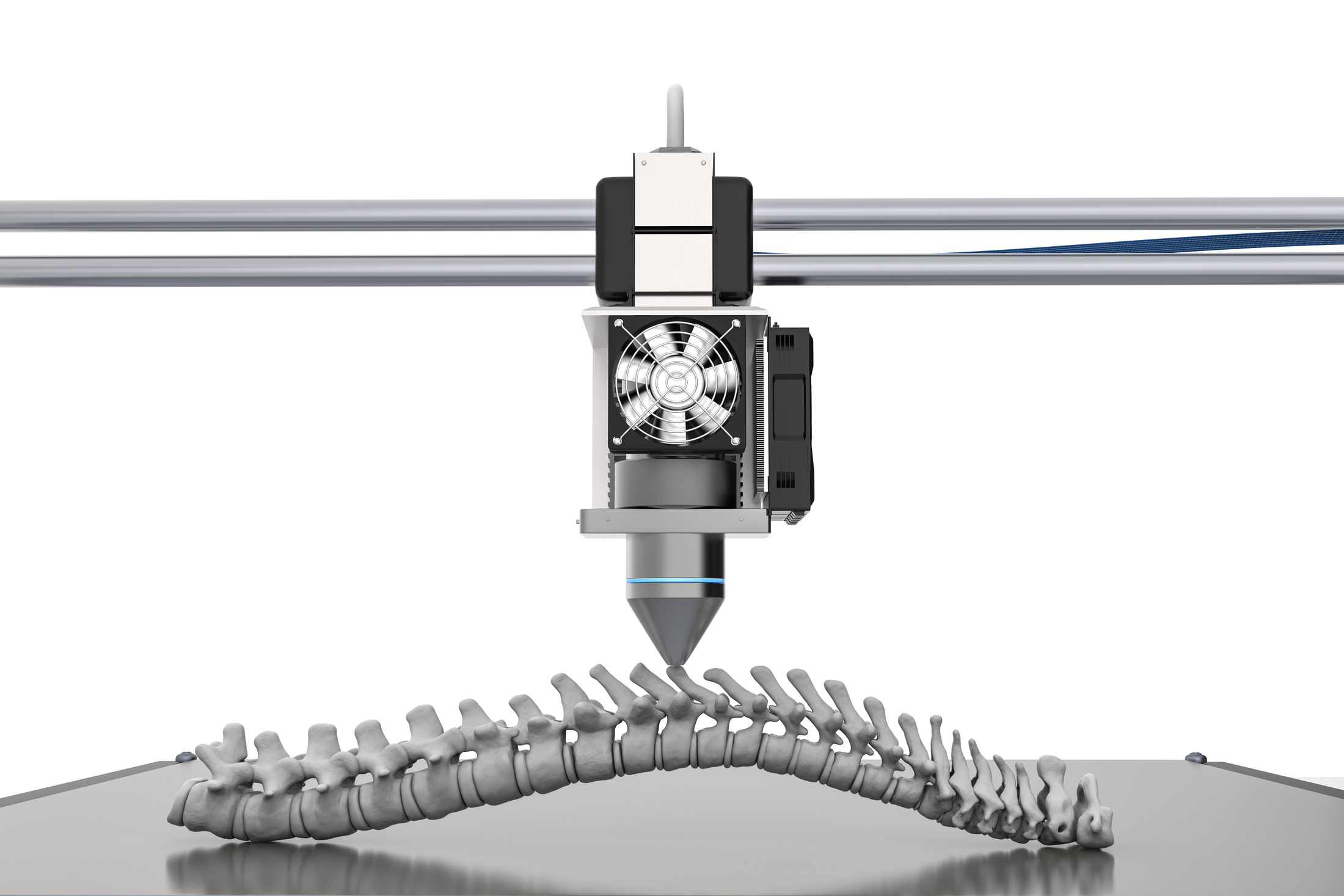 3D Printer Print Prosthetic Spine